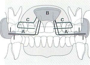 bites-ortodonzia