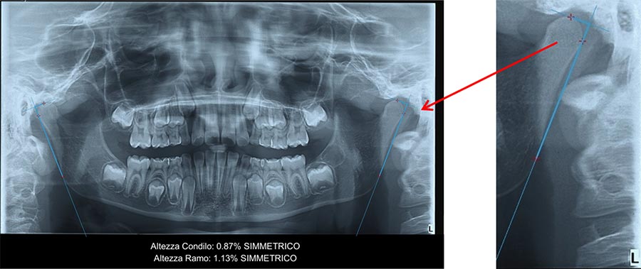 ortopantomografia-dentaria